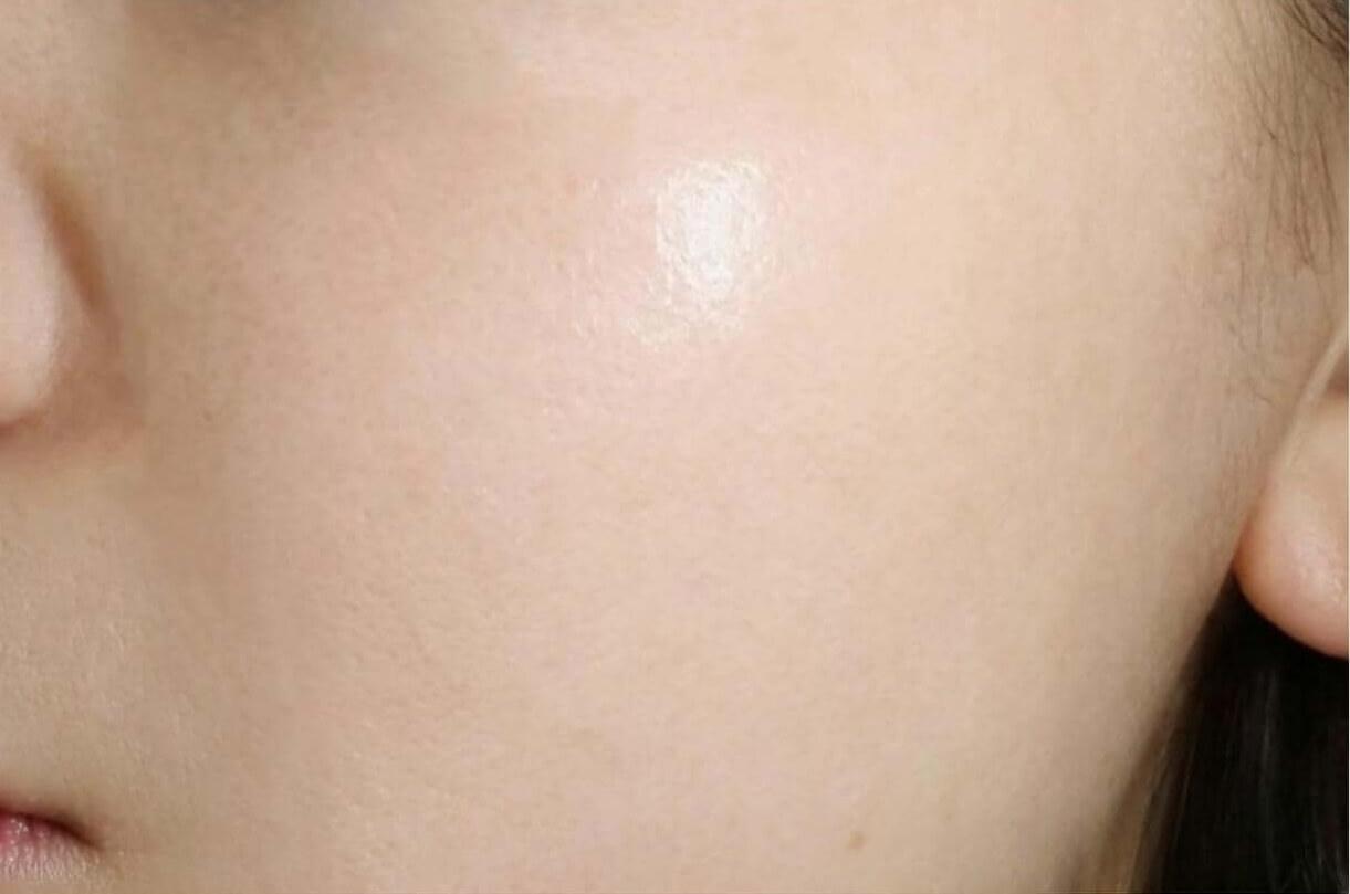enhance-skin-after enhance-skin-after